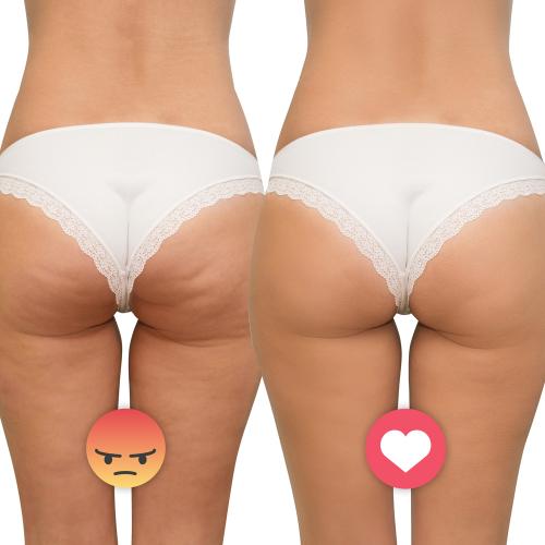 Ultrasonic Massager inSPORTline Valeri 2